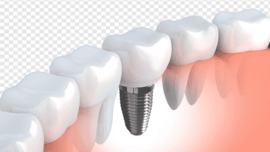 Dental 3D Models