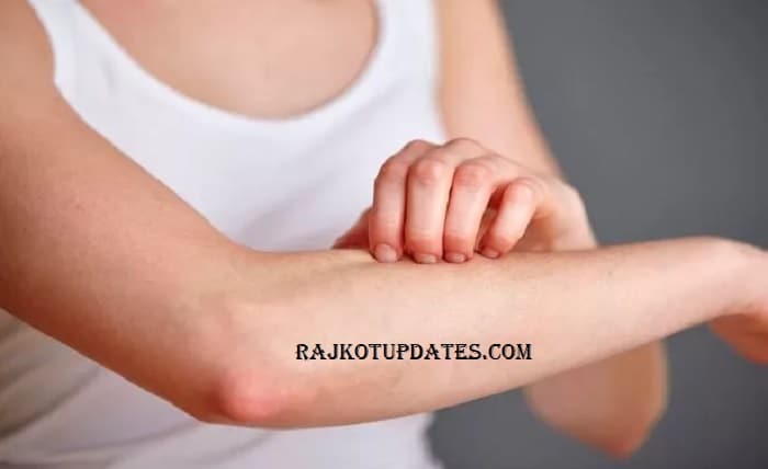 Rajkot Update News This Symptom of Omicron Appears Only on the Skin