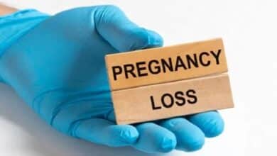 Recurrent Pregnancy Loss