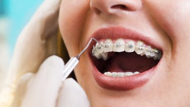 Orthodontic Treatment