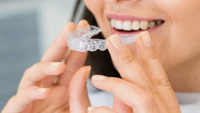 Clear Aligners