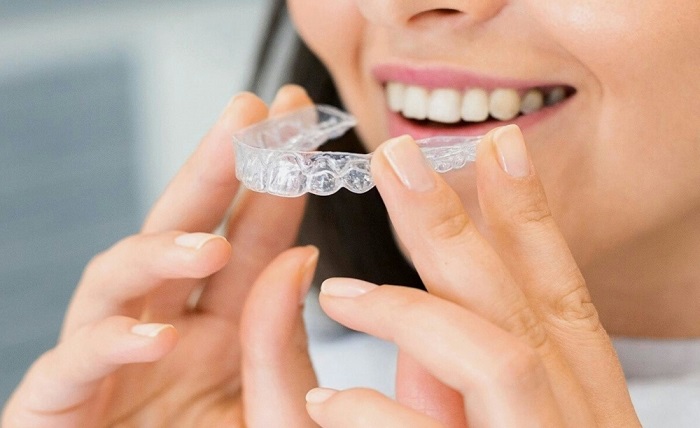 Clear Aligners