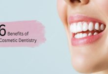 6 Cosmetic Dentistry