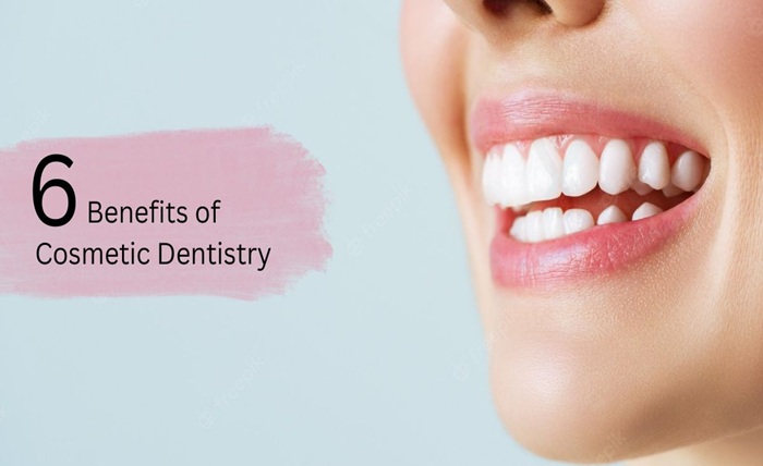 6 Cosmetic Dentistry