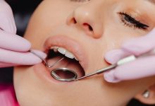 Cosmetic Dentistry