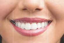 Cosmetic Dentists