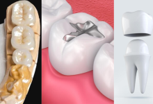 Dentistry Treatments