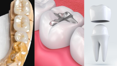 Dentistry Treatments