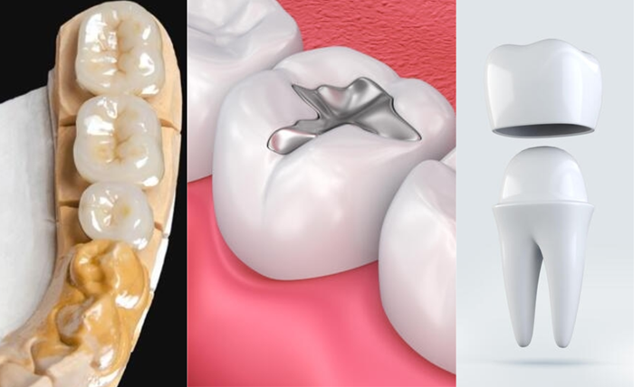 Dentistry Treatments