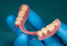 Denture