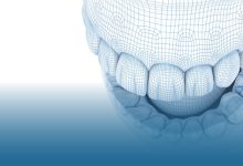 Digital Dentistry