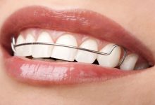 Straight Teeth
