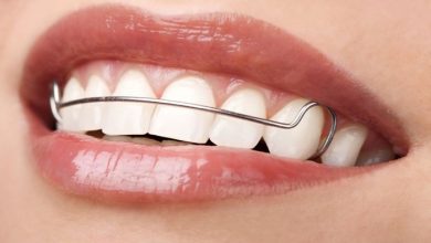 Straight Teeth
