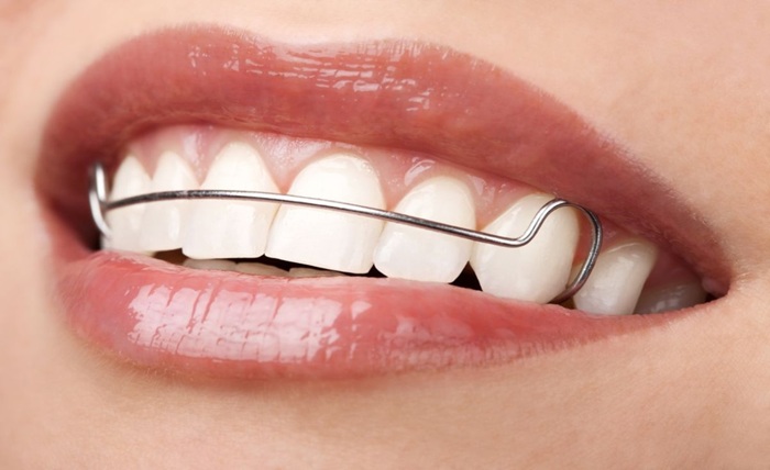Straight Teeth