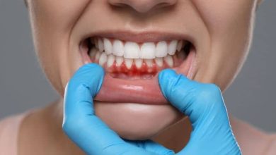 Dentistry Supports