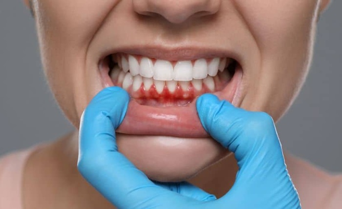 Dentistry Supports